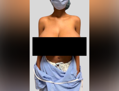 19-Year-Old’s Breasts Balloon from B Cup to Triple G After Pfizer COVID-19 Vaccine — Researchers Call It First-of-its-Kind Case | The Gateway Pundit