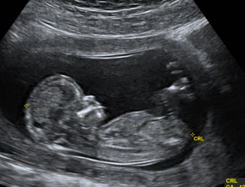 Woman Stuns Crowd at Far Left UC Berkeley with Powerful Prolife Message (Video) | The Gateway Pundit